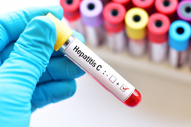  Gegužės 19-oji – Pasaulinė hepatito C diena
